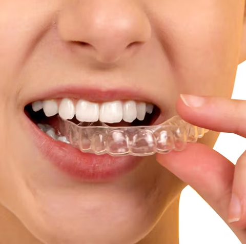 Clear Aligners