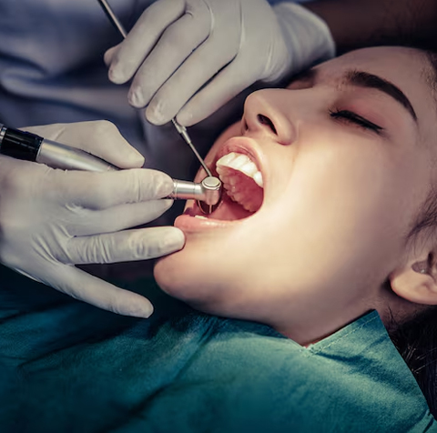 Root Canal Treatment